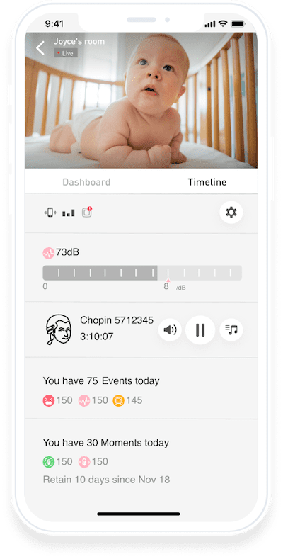 Lollipop Monitor de bebé (pistacho), con monitoreo de respiración sin  contacto (no requiere sensor adicional, servicio de suscripción),  seguimiento